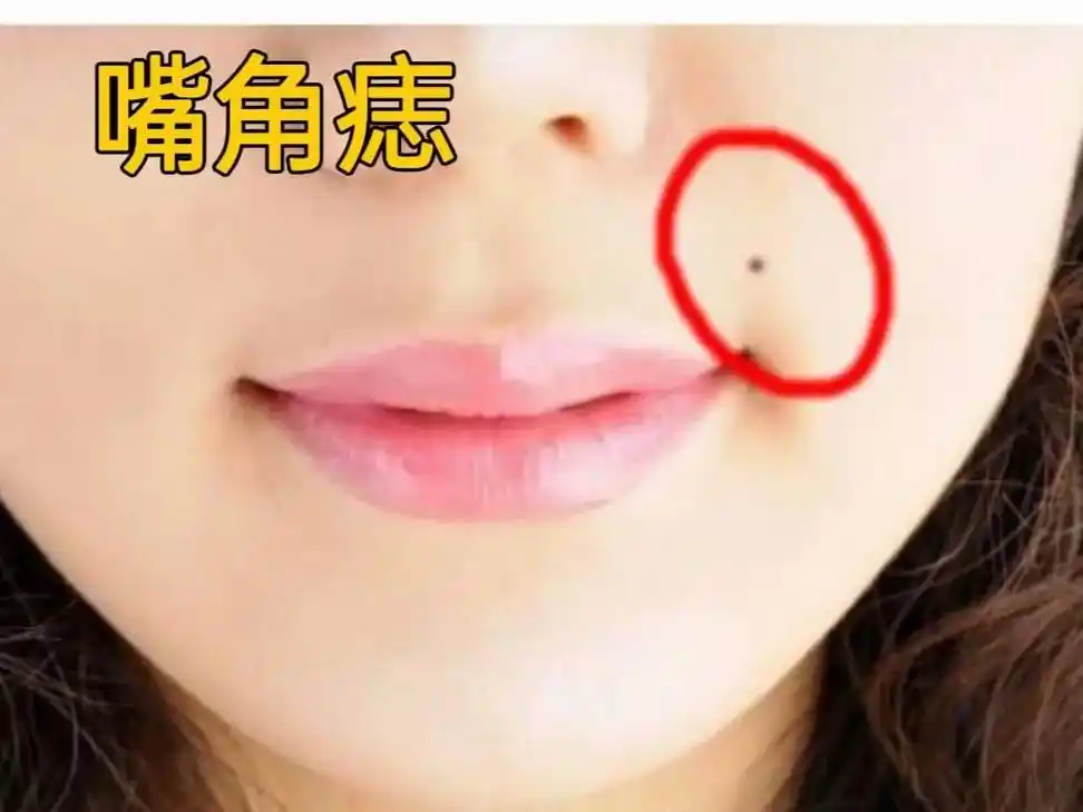 嘴角有痣是食痣