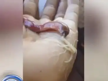 男子庭院发现红色怪虫,拿在手上后虫子的变化让他不寒而栗