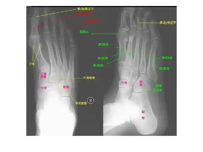 正常人体各部位x线详解ppt