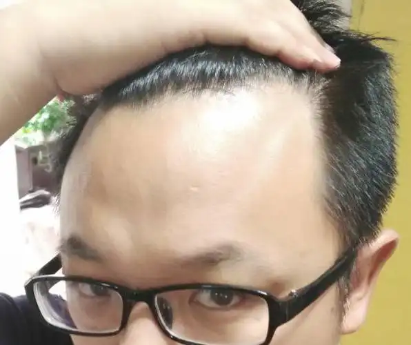 额头有块骨头,凸起明显.这是命理.