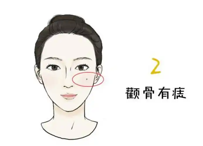 五,颧骨有痣
