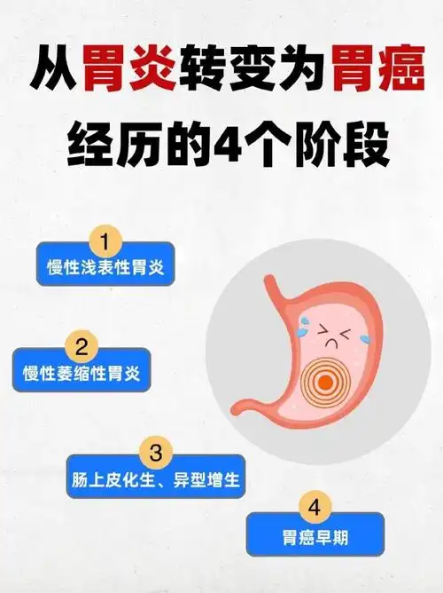警惕胃癌早期5大症状|||04大部分人做检查,好像胃部多少有些毛病