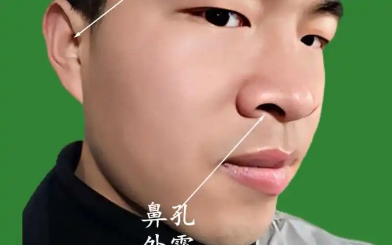 男人长有"鸡嘴耳!