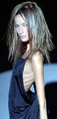 英女孩为减肥一天步行12小时瘦成骷髅图