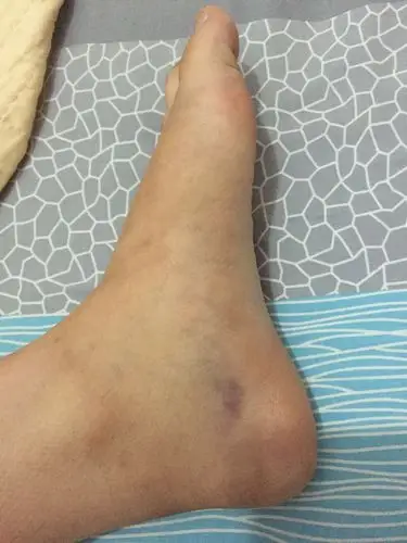 如何治愈好的快些谢谢!