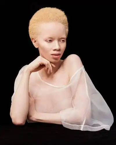 hopa成为了全世界第一位登上vogue期刊封面的白化病患者:她的照片真的