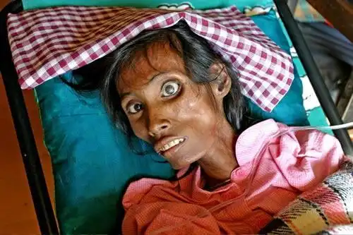 人体消瘦应检查什么呢?