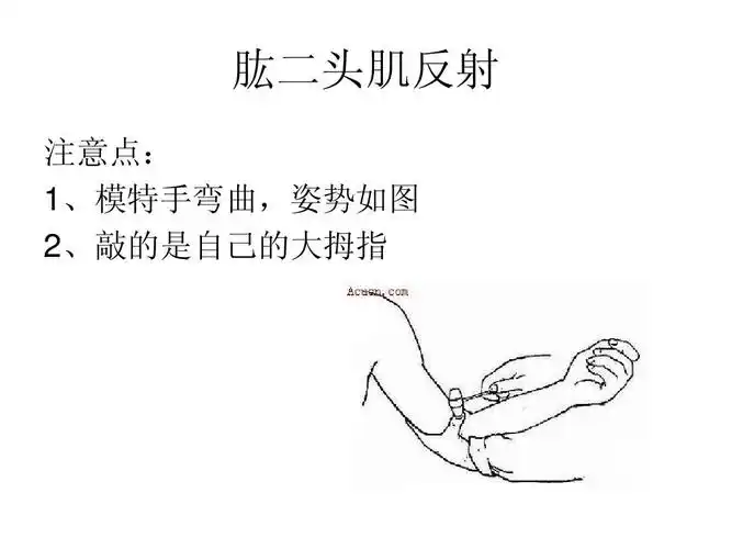 肱二头肌反射 注意点: 1,模特手弯曲,姿势如图 2,敲的是自己的大拇指