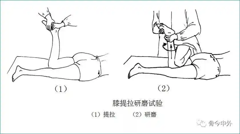 踝部前抽屉试验【视频】运动损伤在升高,你中招了吗?