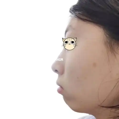 求懂得姐妹看看丨下巴后缩