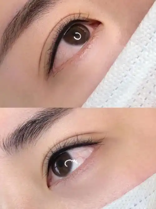 两个月后的美瞳线两个月后的美瞳线效果图也是一冲动就_圈子-新氧美容