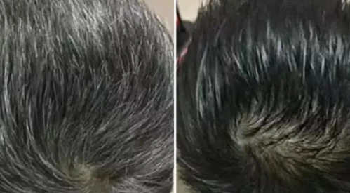 及时调理,恢复乌黑浓密!_头发