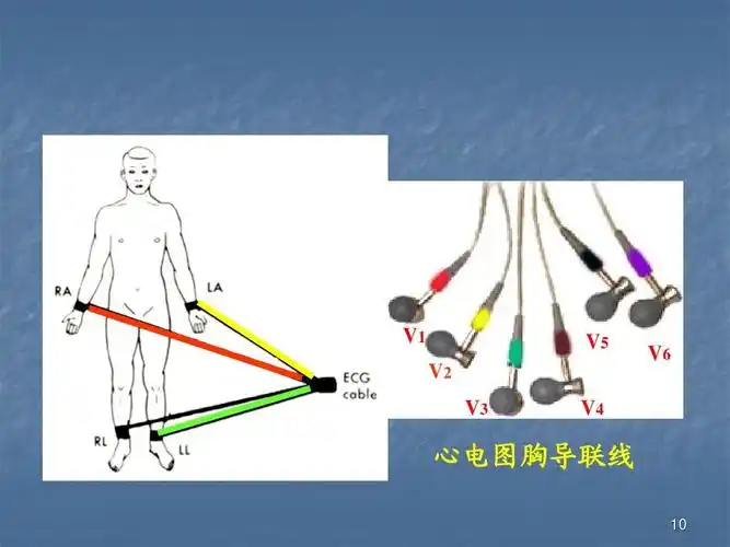 二,心电图导联和ppt
