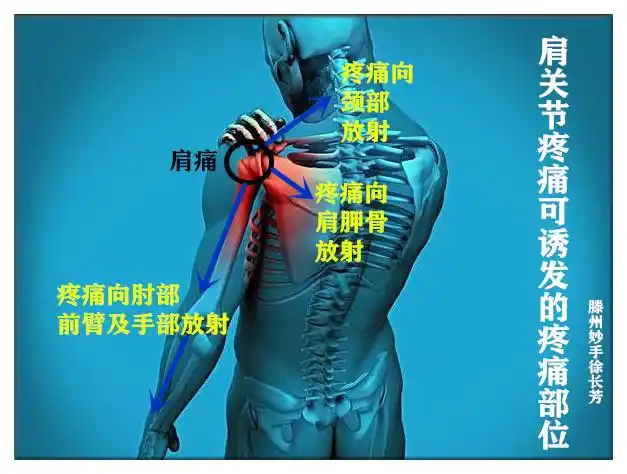 疼痛发作时可向肩胛部,颈部