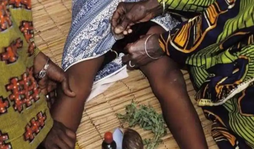 割礼女性是割哪里(割礼女性是割哪里视频)