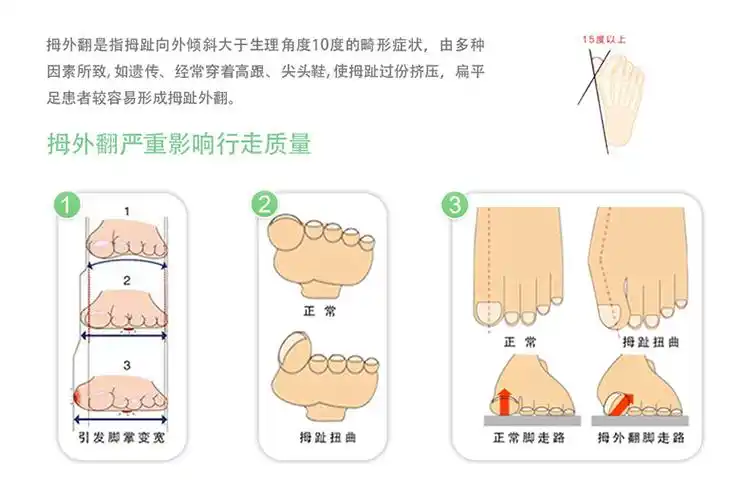 天泽利民护理护具专营店商品编号:10363396840商品名称:科能 脚趾拇