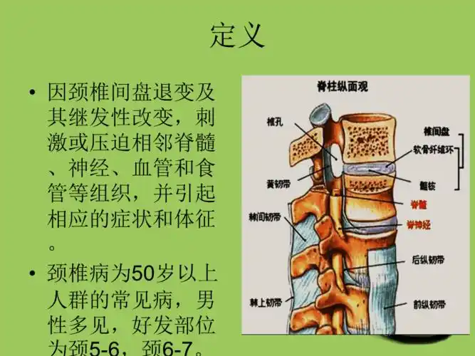 脊髓型颈椎病患者的个案护理查房