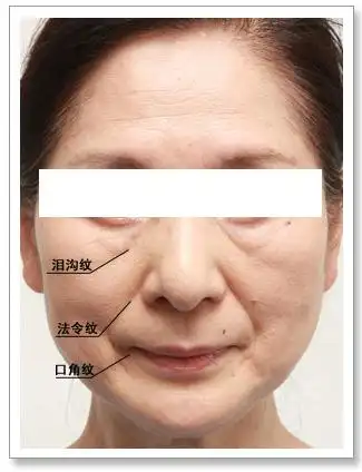 "三八线"让你老了不止10岁,这样做就对了!