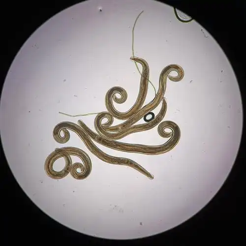 细粒棘球绦虫原头蚴(共 4 张)*作品名称和描述均为参赛者提供,不代表