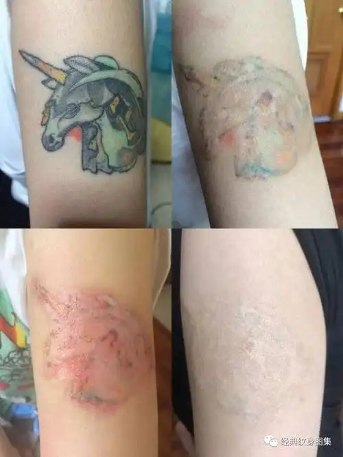 洗纹身必看(很重要的注意事项!