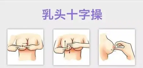 乳头凹陷该怎么办