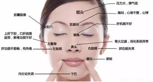 不同位置痘痘代表什么脸上长痘刮痧拔罐艾灸总有一款适合你