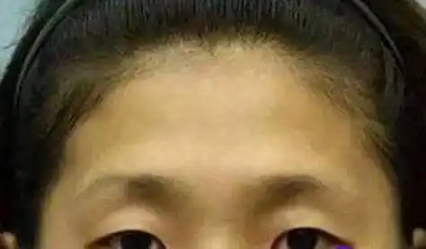 额头有个凹陷代表什么