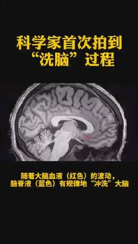 科学家发现鼻后有个大脑污水系统