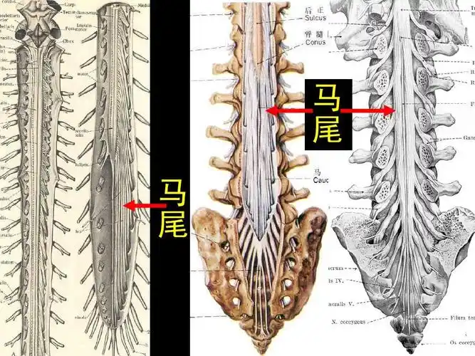 椎管解剖-腰麻,骶管麻醉基础ppt