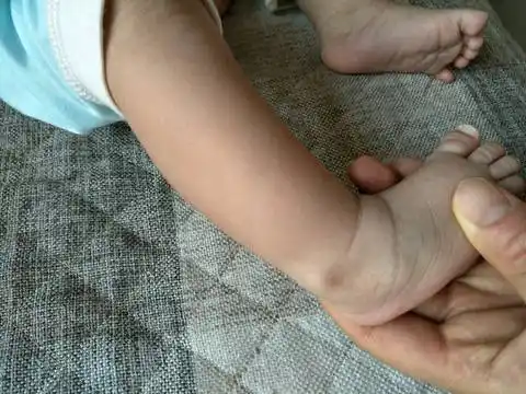 宝宝俩个月了,发现脚踝骨外侧的筋来回动,大家谁知道怎麼回事?