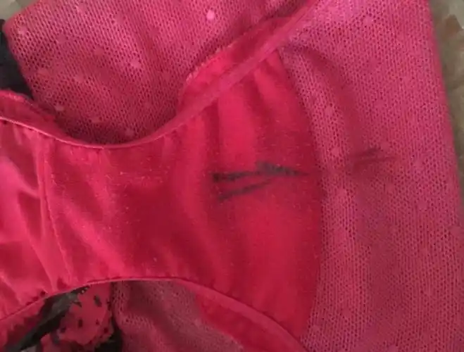 年轻女性若是经常在上厕所的时候发现内裤上有血迹或是疑似血迹的东西