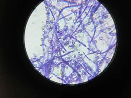 请问这是在1600倍看到的霉菌装片,视野中的小颗粒是什么?