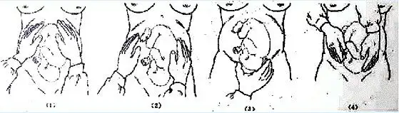 有关产科的四步触诊法错误的一项是