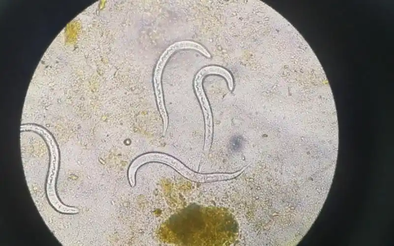 粪类圆线虫