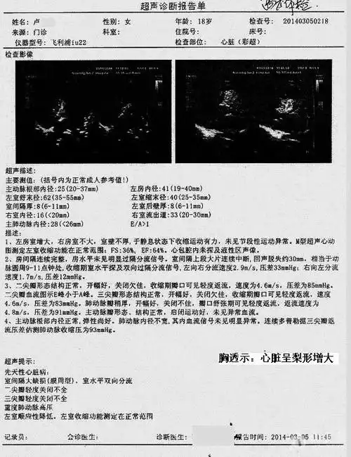 先天性心脏病你考虑那个心室大