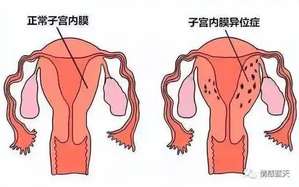 揭秘中国女人子宫的真相,3点实例让你大开眼界!_女性_遗传_运动