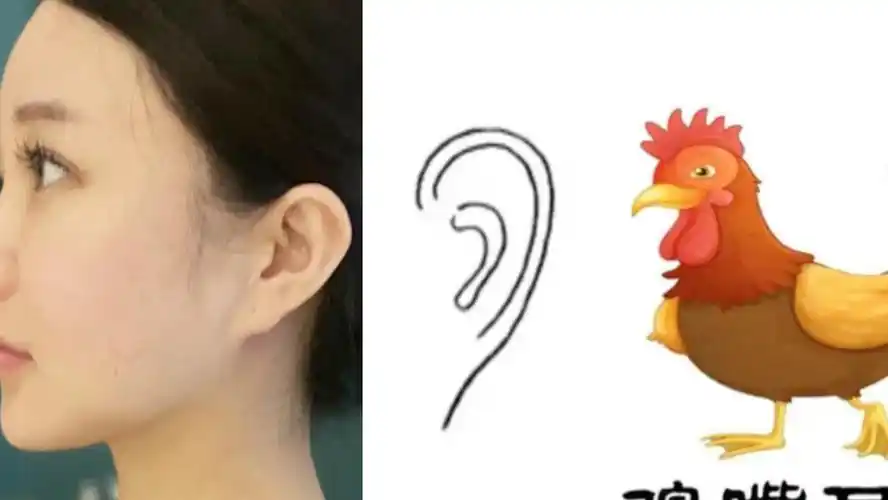 鸡嘴耳是什么样的呢?有什么特征呢?