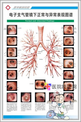 医院呼吸系统科系列解剖挂图支气管镜检图谱图片海报定制 电子支气管