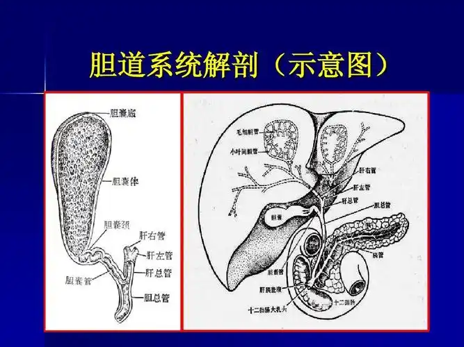 胆系疾病影像诊断ppt