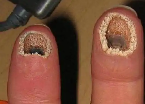 世界十大最恶心的图片:你能忍到第几张(图)