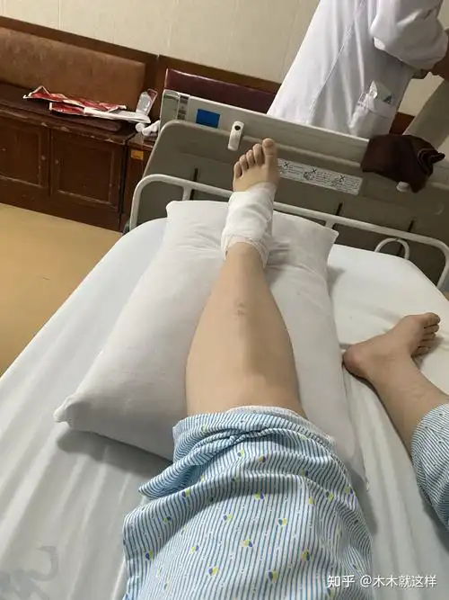 第五跖骨基底骨折全记录6.26.