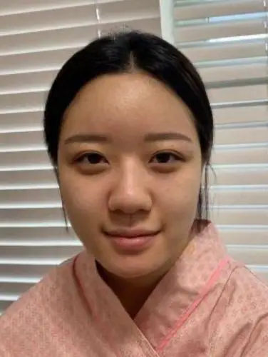 蒜头鼻变形记|从低山根蒜头鼻逆袭成女团脸!