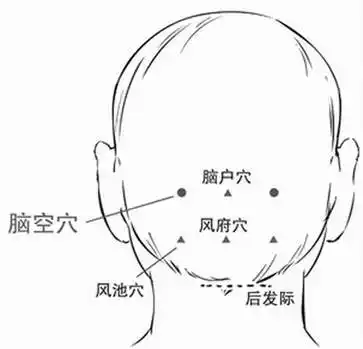5寸处,脑户位置图和作用机理为天之下部的湿冷水气,对人体的头部有