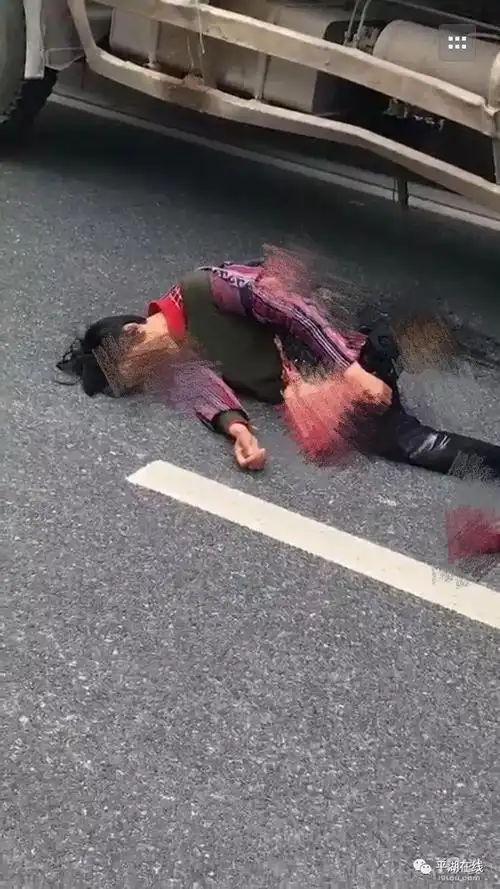 现场图片(已打码)网友爆料女子腿被当场碾断,血肉模糊.突发惨烈车祸!