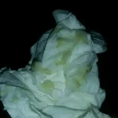 15周白带很多几乎就像粉肠里的一样无异味,请问正常吗?