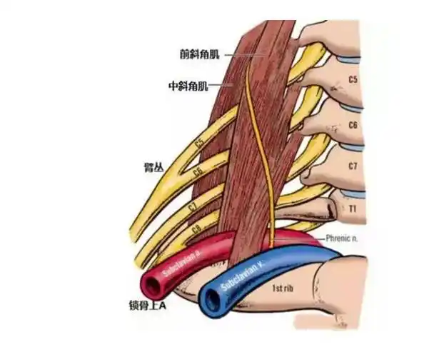 手臂麻!颈椎病最重要的一块肌肉-斜角肌