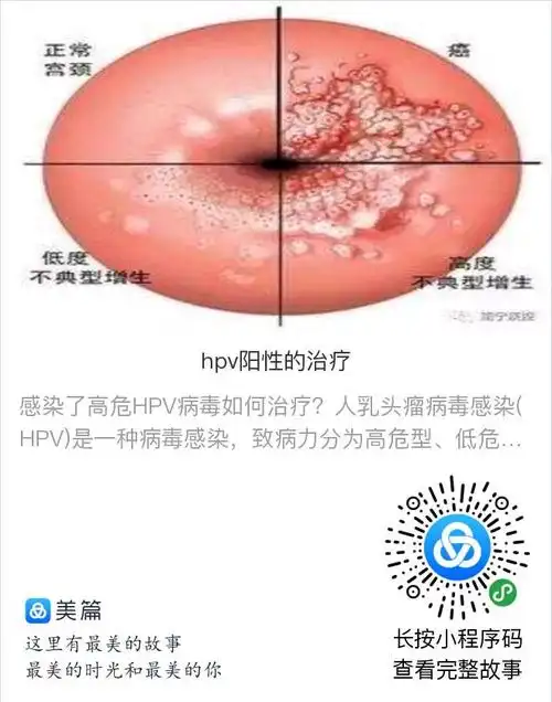 hpv阳性是什么意思?