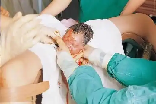 几张图带你看顺产的全过程产妇在医院自然分娩全过程,生娃着实不易