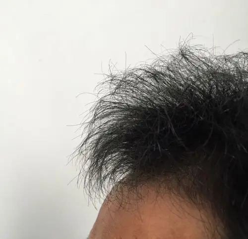 头发像杂草堆似的 怎么样改善发质 用什么洗发水?