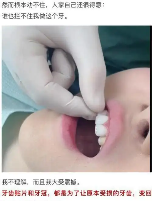 全网热议的"花几万做宝宝牙"事件:幼态审美,正在背刺年轻女性